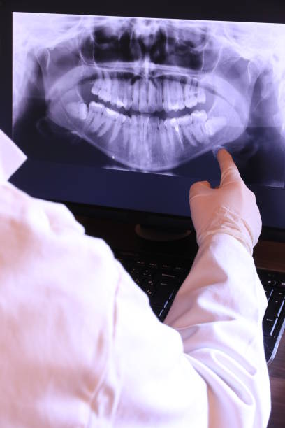Best Emergency Treatment for Dental Infections or Abscesses in Williamsville, NY