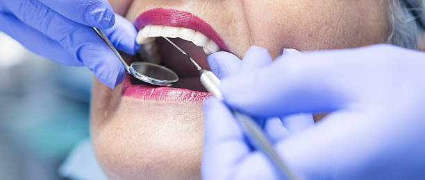 Best Urgent Care for Lost Fillings or Crowns in Williamsville, NY
